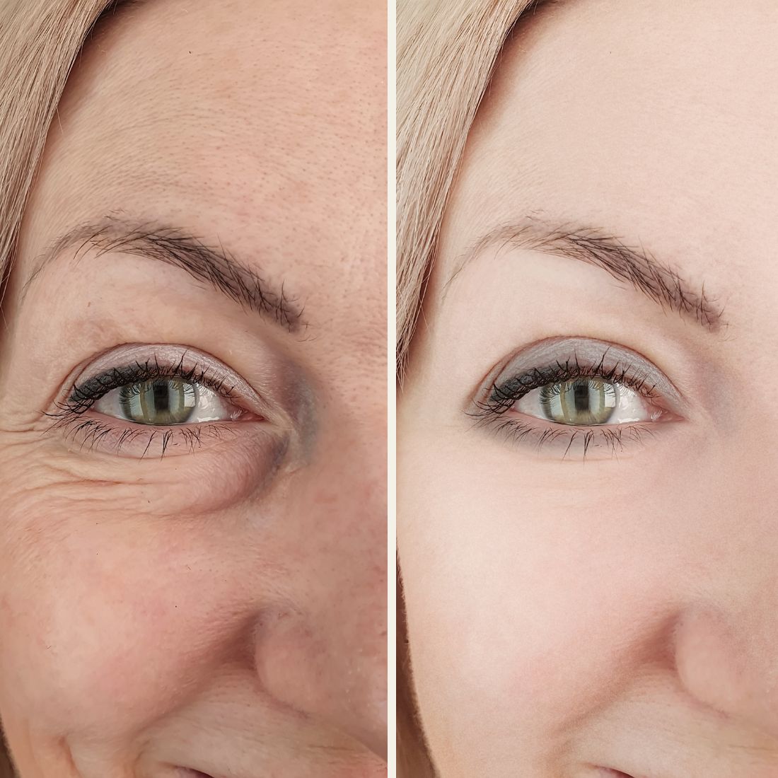 Before And After Aurora Plastic Surgery 2