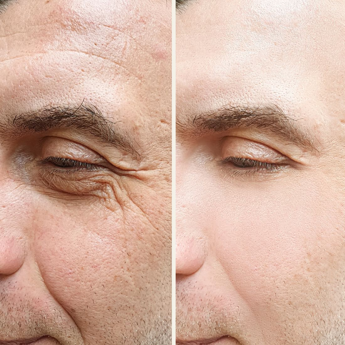 Before And After Aurora Plastic Surgery 3