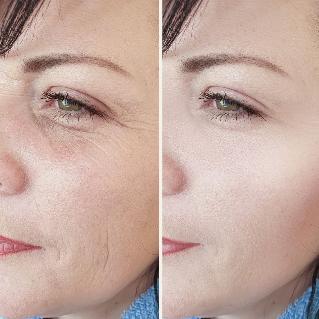 Before And After Aurora Plastic Surgery 4