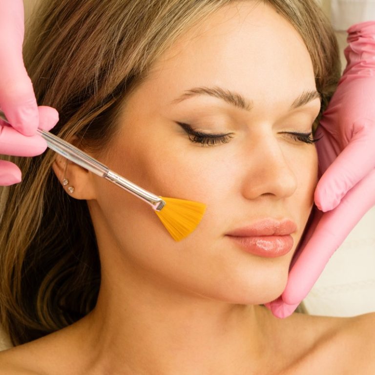 APS Service Main - chemical peel