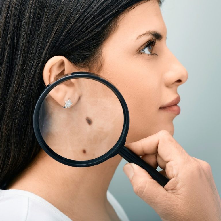 APS Service Main - skin biopsy