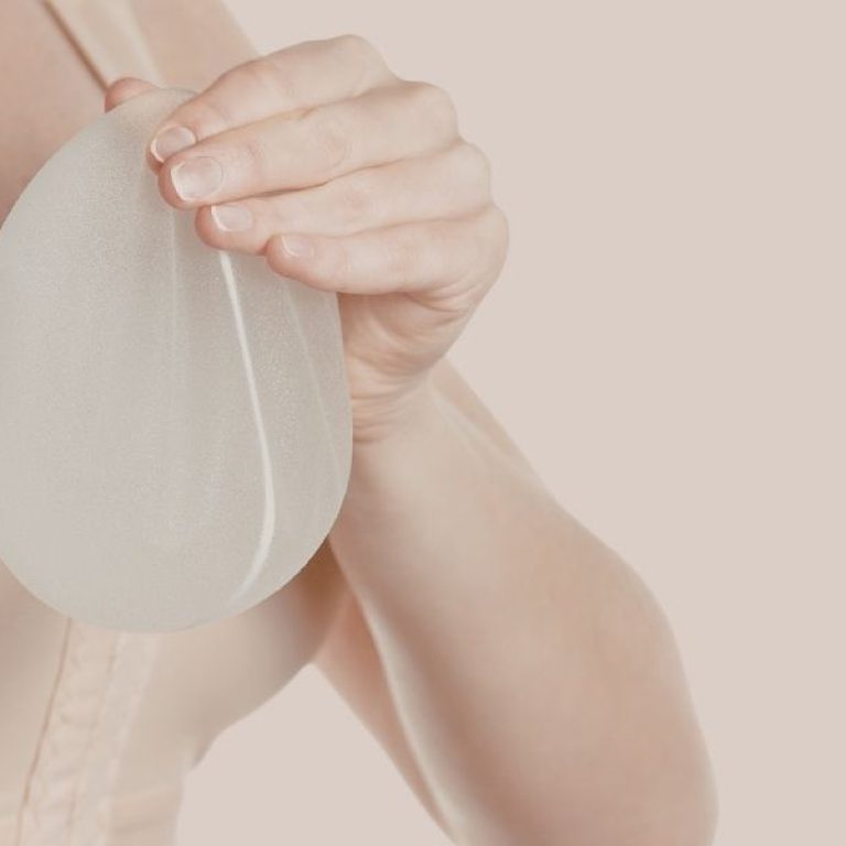 Breast Augmentation in Aurora What to Know Beforehand