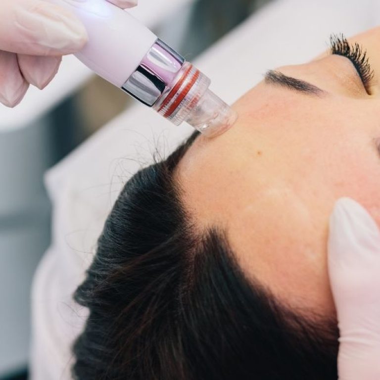 HydraFacial vs. Traditional Facial