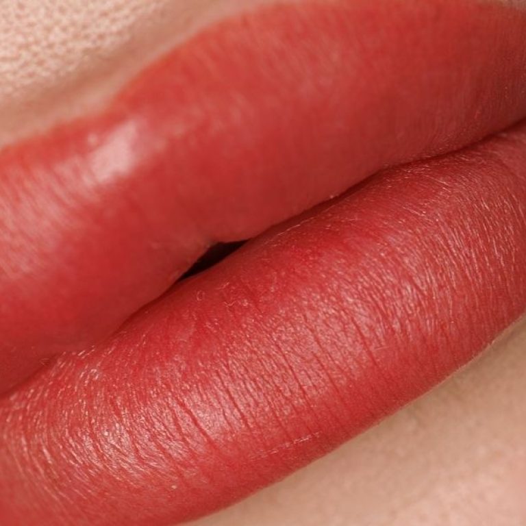 Lip Fillers 101 A Complete Beginner’s Guide (aurora, barrie, newmarket)