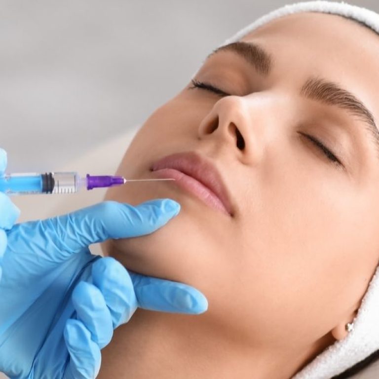 Natural vs. Full Lips Finding the Right Balance with Lip Fillers