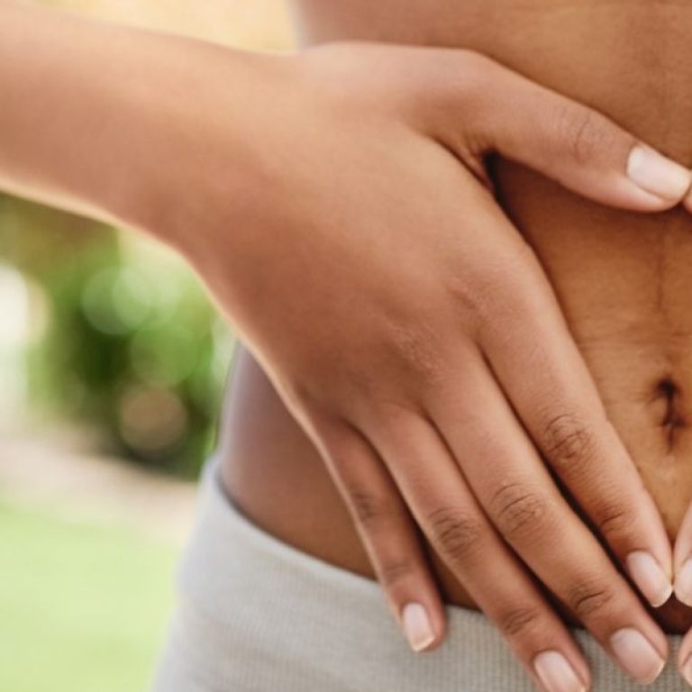 Tummy Tuck Surgery in Aurora Who Is a Good Candidate