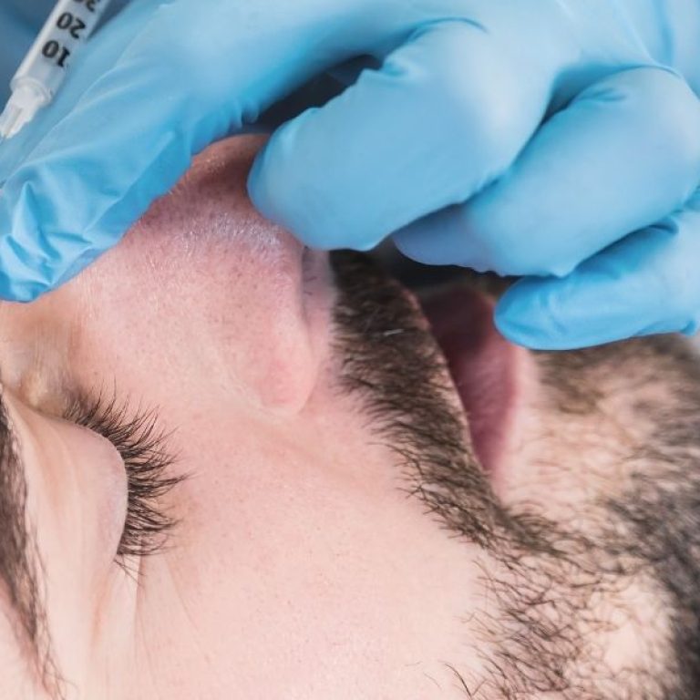 Why More Men Are Choosing Dermal Fillers in 2025